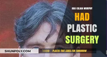 Cillian Murphy Plastic Surgery: Fact or Fiction? Unveiling the Truth