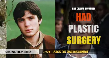 Cillian Murphy Plastic Surgery: Fact or Fiction? Unveiling the Truth