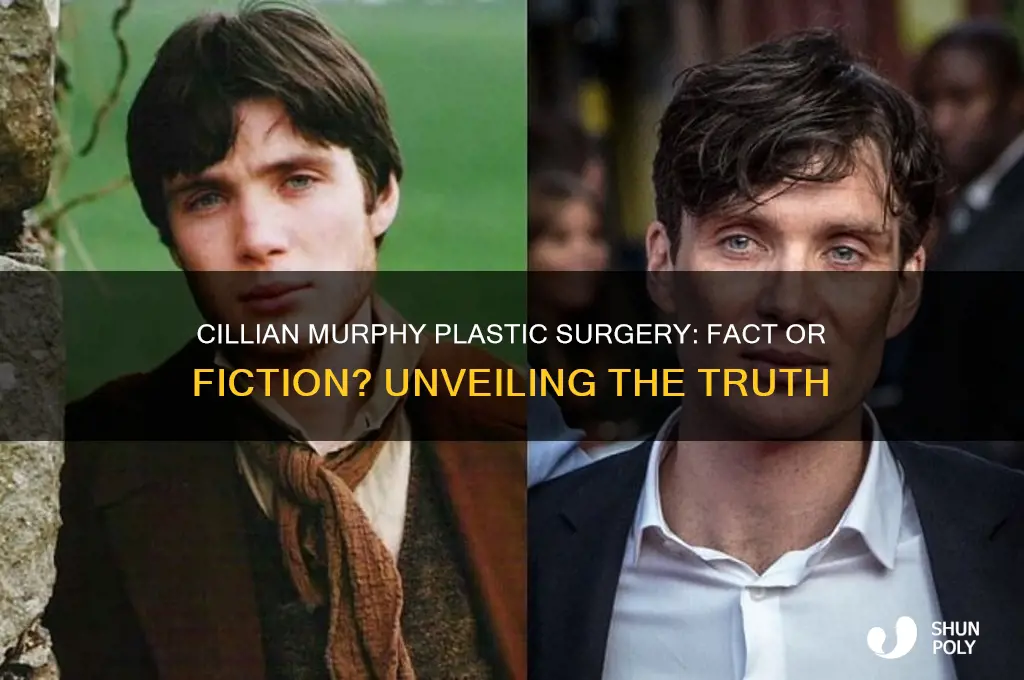 has cillian murphey had plastic surgery