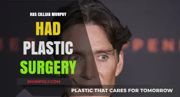 Cillian Murphy's Transformation: Plastic Surgery Rumors Explored