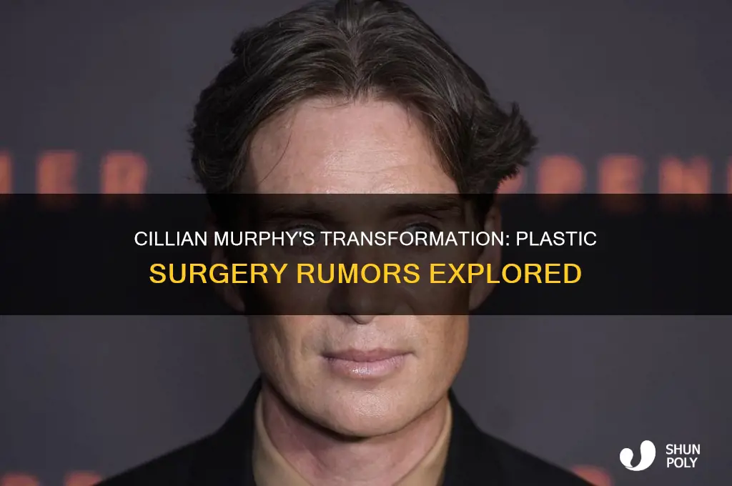 has cillian murphy had plastic surgery