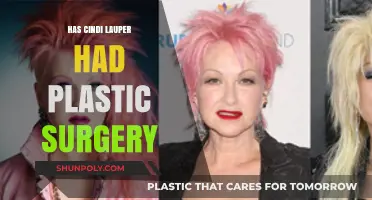 Cindy Lauper's Transformation: Plastic Surgery Rumors and Reality Revealed
