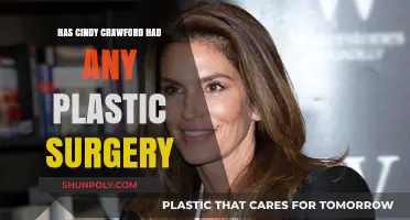 Cindy Crawford's Beauty Secrets: Plastic Surgery Rumors Explored
