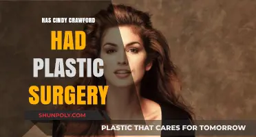 Cindy Crawford's Ageless Beauty: Plastic Surgery Speculations Explored