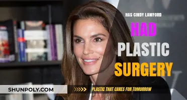 Cindy Lawford's Transformation: Plastic Surgery Speculations and Truths