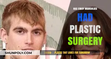 Cindy Margulies Plastic Surgery: Fact-Checking the Rumors and Speculations