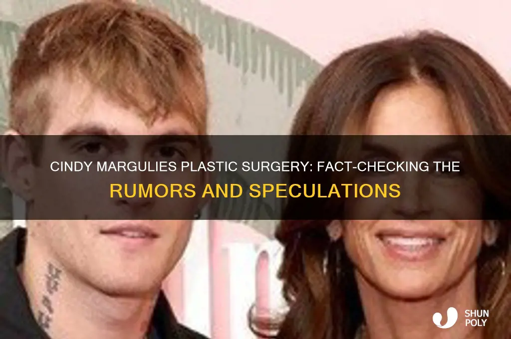 has cindy margulies had plastic surgery