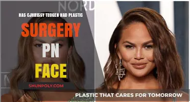 Chrissy Teigen's Facial Transformation: Plastic Surgery Speculations Explored