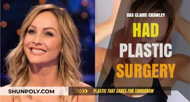 Claire Crawley's Transformation: Plastic Surgery Speculations and Truths Revealed