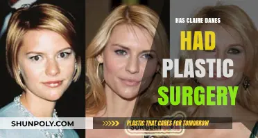 Claire Danes Plastic Surgery: Fact or Fiction? Uncovering the Truth