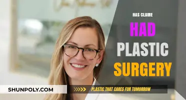 Has Claire Had Plastic Surgery? Unveiling the Truth Behind Her Look