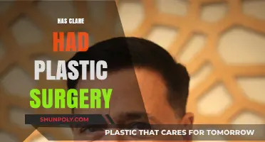 Has Clare Had Plastic Surgery? Uncovering the Truth Behind Her Look