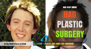 Clay Aiken's Transformation: Plastic Surgery Rumors Explored
