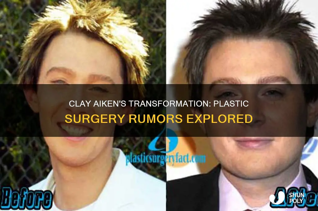 has clay aiken had plastic surgery
