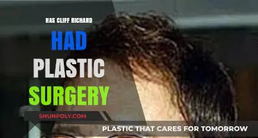 Has Cliff Richard Had Plastic Surgery? Unveiling the Truth