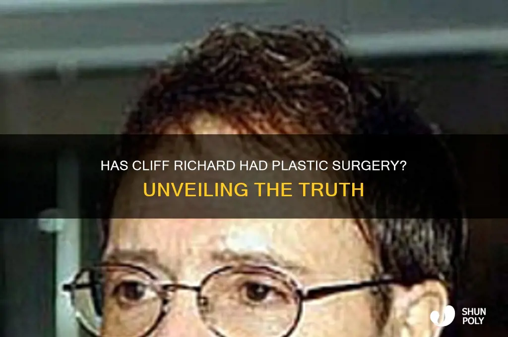 has cliff richard had plastic surgery