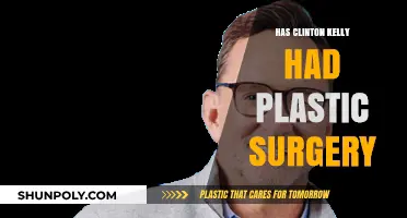 Clinton Kelly's Transformation: Plastic Surgery Speculations and Truths