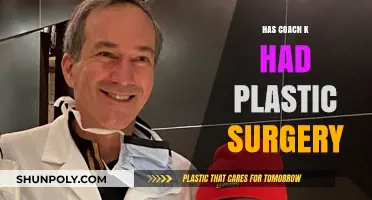 Coach K Plastic Surgery Speculations: Fact or Fiction?
