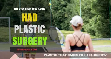 Coco Love Island Plastic Surgery: Fact-Checking the Transformation Rumors