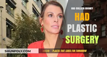Colleen Rooney's Transformation: Plastic Surgery Speculations and Truths Revealed