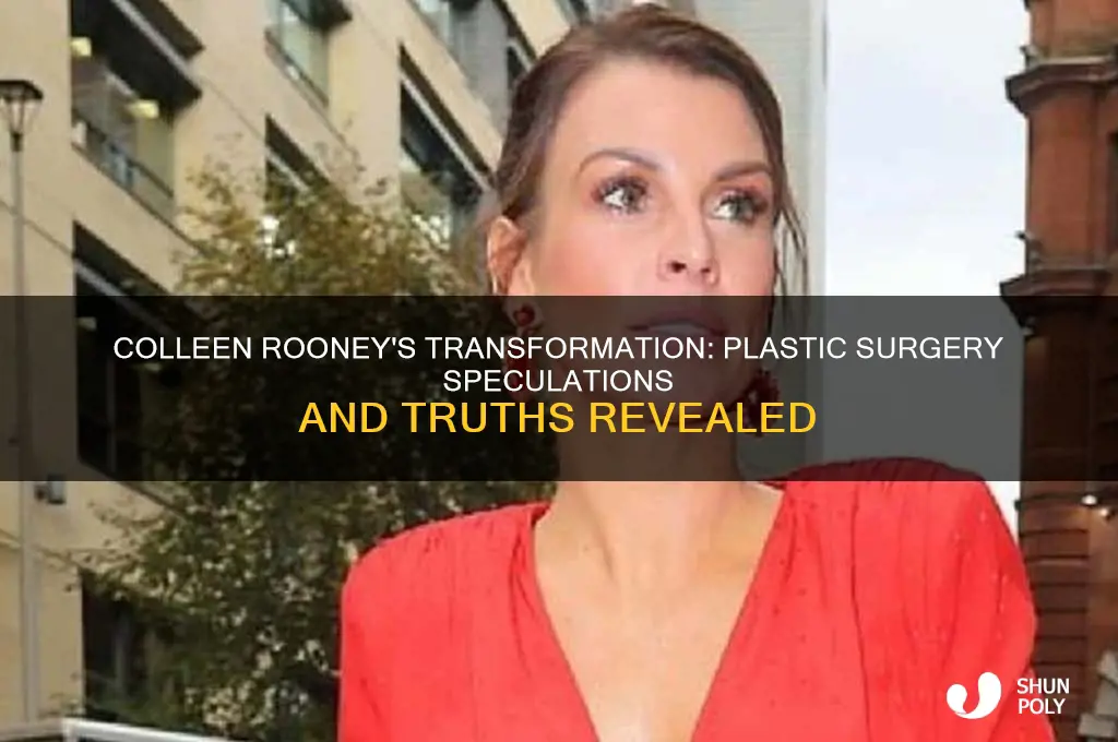 has colleen rooney had plastic surgery
