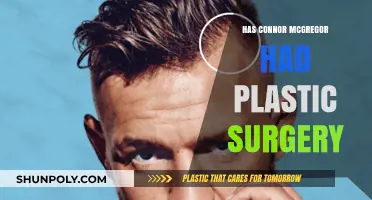 Has Conor McGregor Had Plastic Surgery? Uncovering the Truth