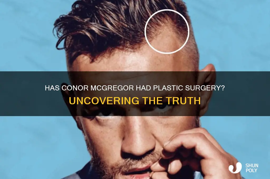 has connor mcgregor had plastic surgery