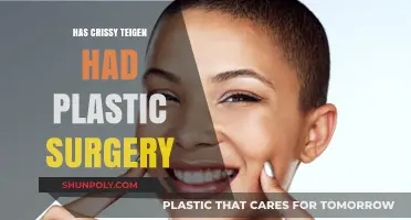 Has Chrissy Teigen Had Plastic Surgery? Unveiling the Truth