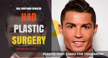 Cristiano Ronaldo's Transformation: Plastic Surgery Speculations Explored