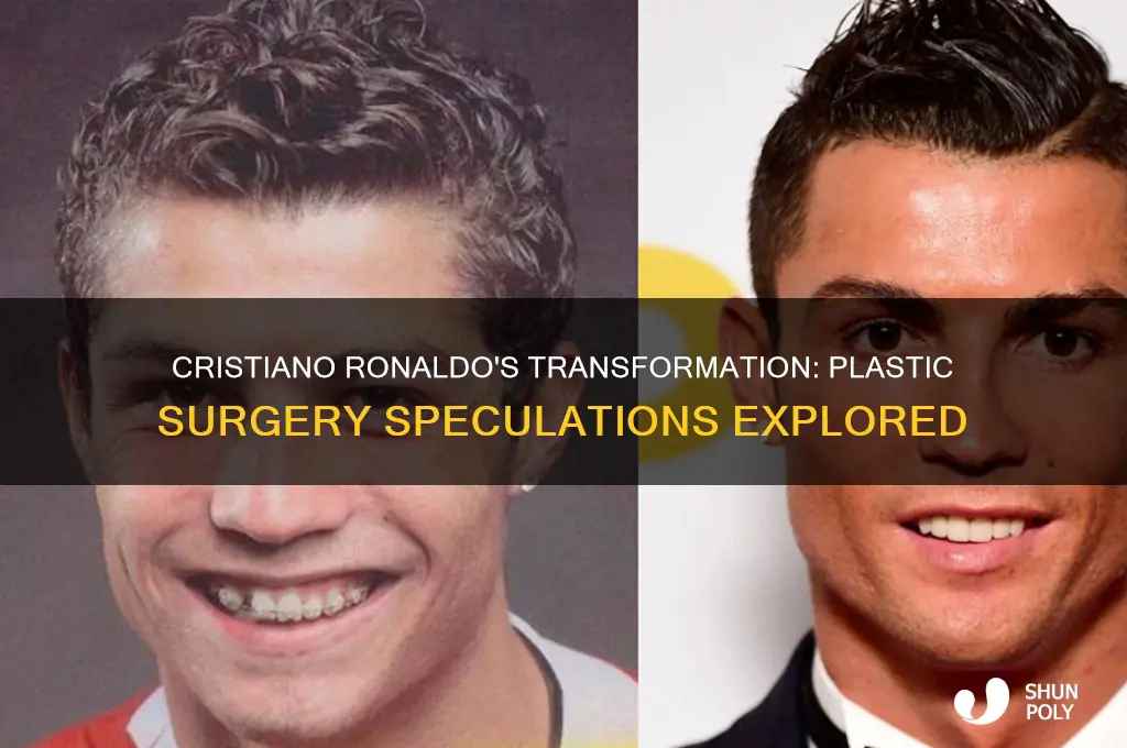 has cristiano renaldo had plastic surgery