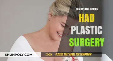 Crystal Crews Plastic Surgery: Fact-Checking the Rumors and Speculations