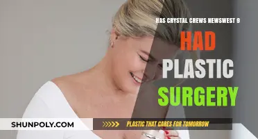 Crystal Crews Newswest 9 Plastic Surgery Speculations: Fact or Fiction?