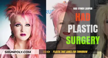 Cyndi Lauper's Transformation: Plastic Surgery Rumors and Reality Revealed