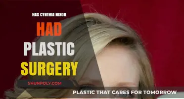 Cynthia Nixon's Transformation: Plastic Surgery Speculations and Truths Revealed