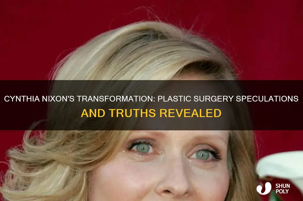 has cynthia nixon had plastic surgery