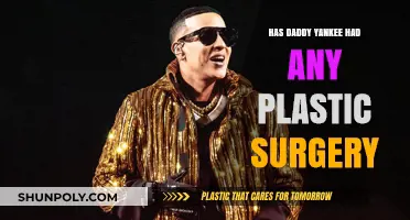 Has Daddy Yankee Had Plastic Surgery? Uncovering the Truth