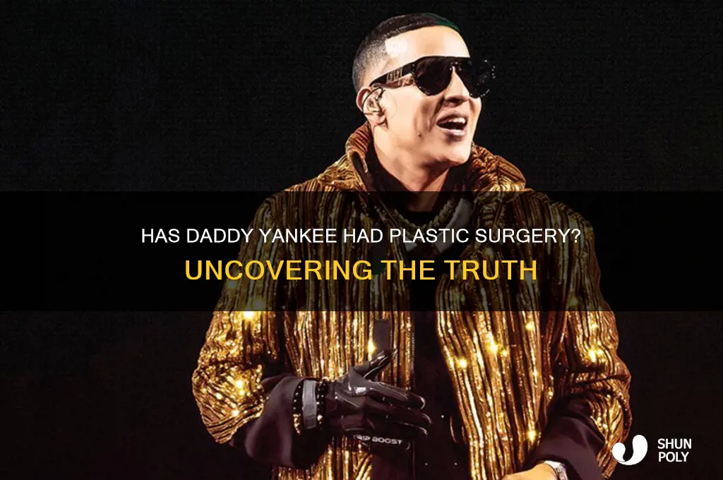 has daddy yankee had any plastic surgery