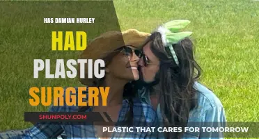 Damian Hurley Plastic Surgery: Fact-Checking the Transformation Rumors