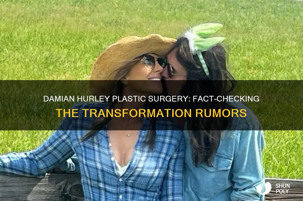 has damian hurley had plastic surgery