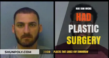 Has Dan Hicks Had Plastic Surgery? Uncovering the Truth