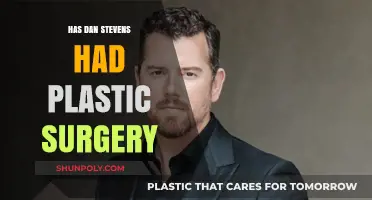 Has Dan Stevens Had Plastic Surgery? Uncovering the Truth