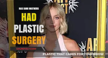 Dani Mathers Plastic Surgery: Fact-Checking the Rumors and Speculations