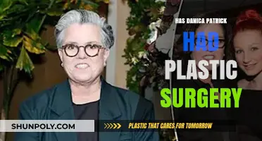 Danica Patrick's Transformation: Plastic Surgery Rumors Explored and Debunked