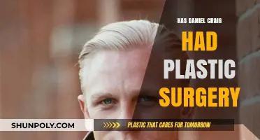 Daniel Craig's Transformation: Plastic Surgery Rumors Explored and Debunked
