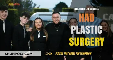 Daniel O'Donnell's Appearance: Plastic Surgery Rumors Explored