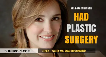 Darcey Bussell Plastic Surgery: Fact-Checking the Rumors and Speculations