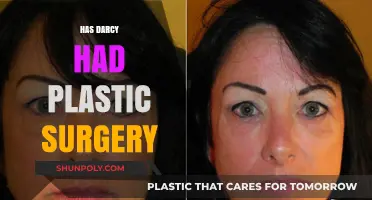 Has Darcy Undergone Plastic Surgery? Unveiling the Truth and Speculations