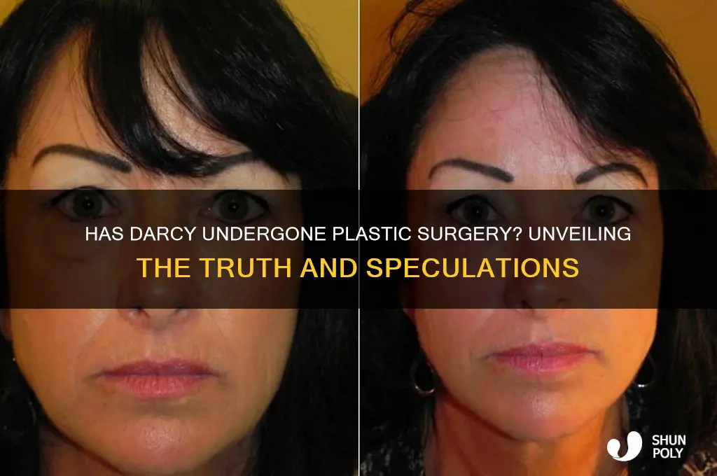 has darcy had plastic surgery