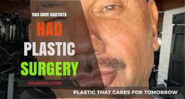 Has Dave Bautista Undergone Plastic Surgery? Examining the Rumors