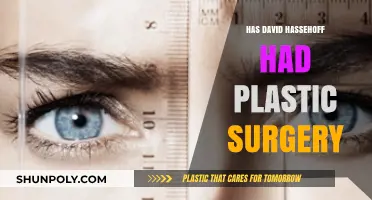 David Hasselhoff's Transformation: Plastic Surgery Rumors Explored